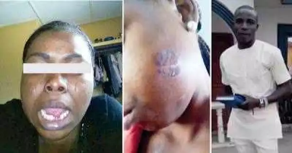 Abia: Male corper batter, removes teeth of female corps member for refusing to date him